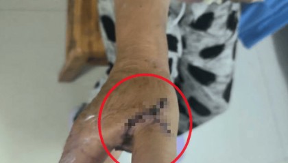 疑打井纠纷，河北邯郸一小学教师杀害33岁邻居，广平县教体局：警方正进一步侦办此案